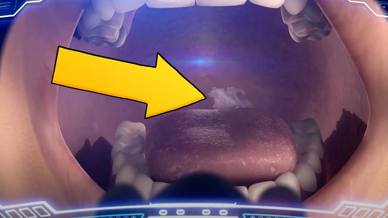 A dental patient's mouth